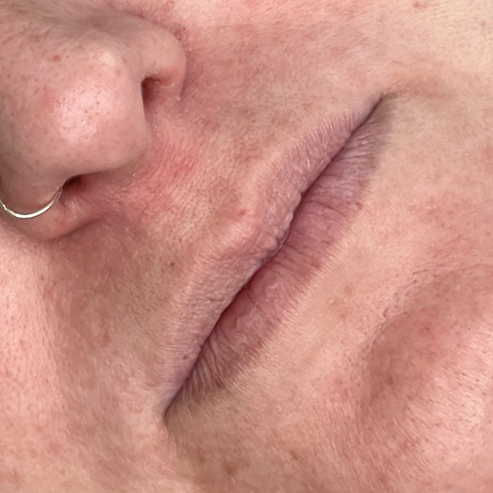 CE183900-C111-40C5-9F25-6122FA69EDBE